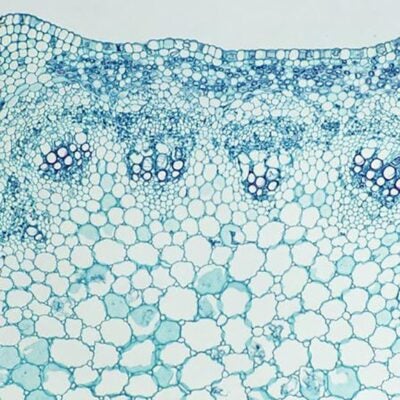 Top oncology breakthroughs shared at ESMO 2021