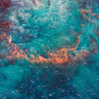 悪性黒色腫のパラダイムチェンジとなるプライマリー第3相データ： オプジーボとの併用によるリラトリマブへの期待感