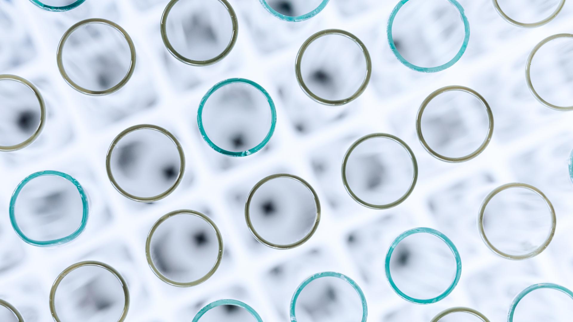 How Patient Connect addresses unmet needs at the point of care [PODCAST]