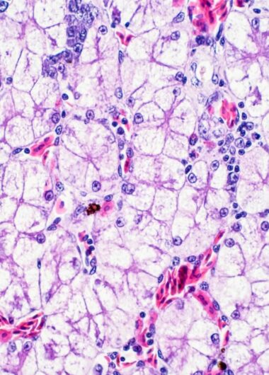 유전자 치료제, 희귀질환의 치료를 변화시키다: 규제, 지불자 및 개발자들이 마주한 과제들과 환자를 위한 희망