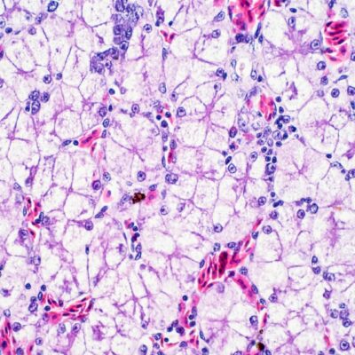 단일 세포 RNA 시퀀싱 적용의 미래