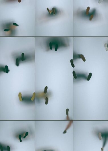 알츠하이머병의 조기진단:더 나은 치료를 위한 첫걸음