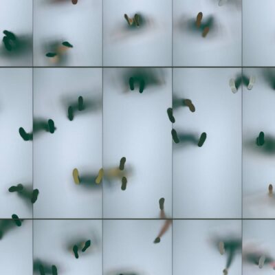 알츠하이머병의 조기진단:더 나은 치료를 위한 첫걸음