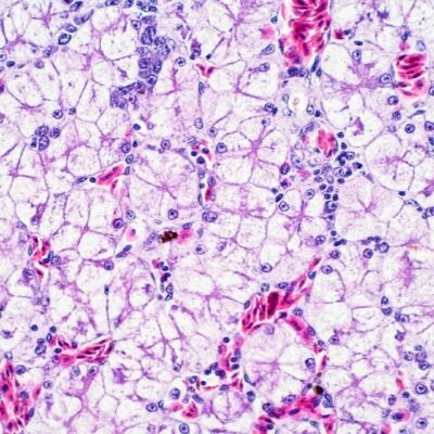 의학분야 ‘마법의 총알’을 노리다: 스스로 발등을 찍는 일일까요?