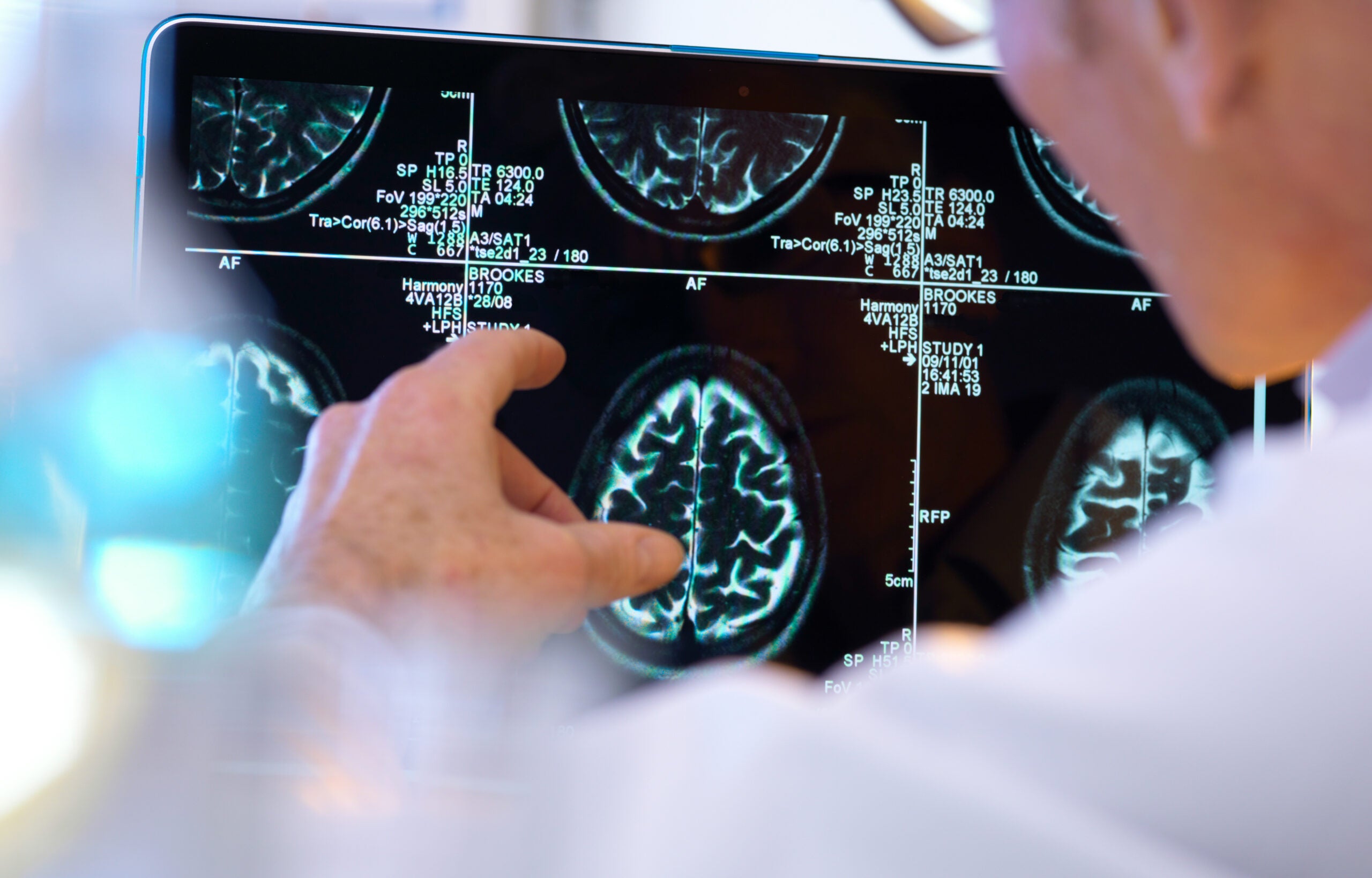 U.S. Contrast Agent and Radiopharmaceutical Market Snapshot