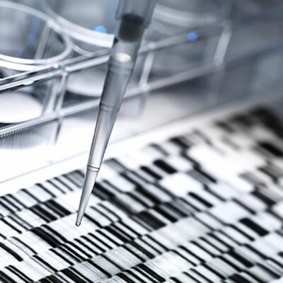 Going to the gemba: healthcare supply chain’s lean transformation