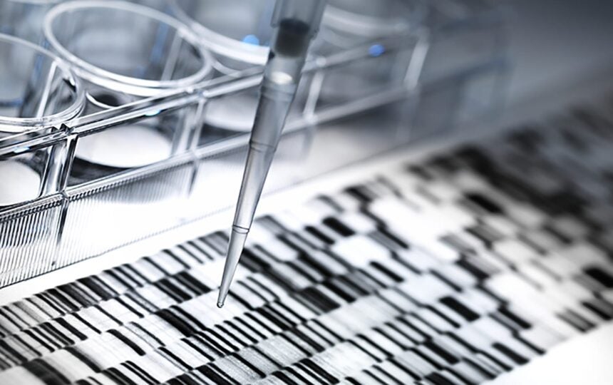 Going to the gemba: healthcare supply chain’s lean transformation