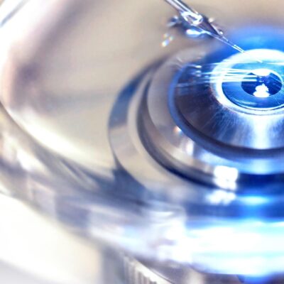 Reprocessing endoscopes: what is the true cost?