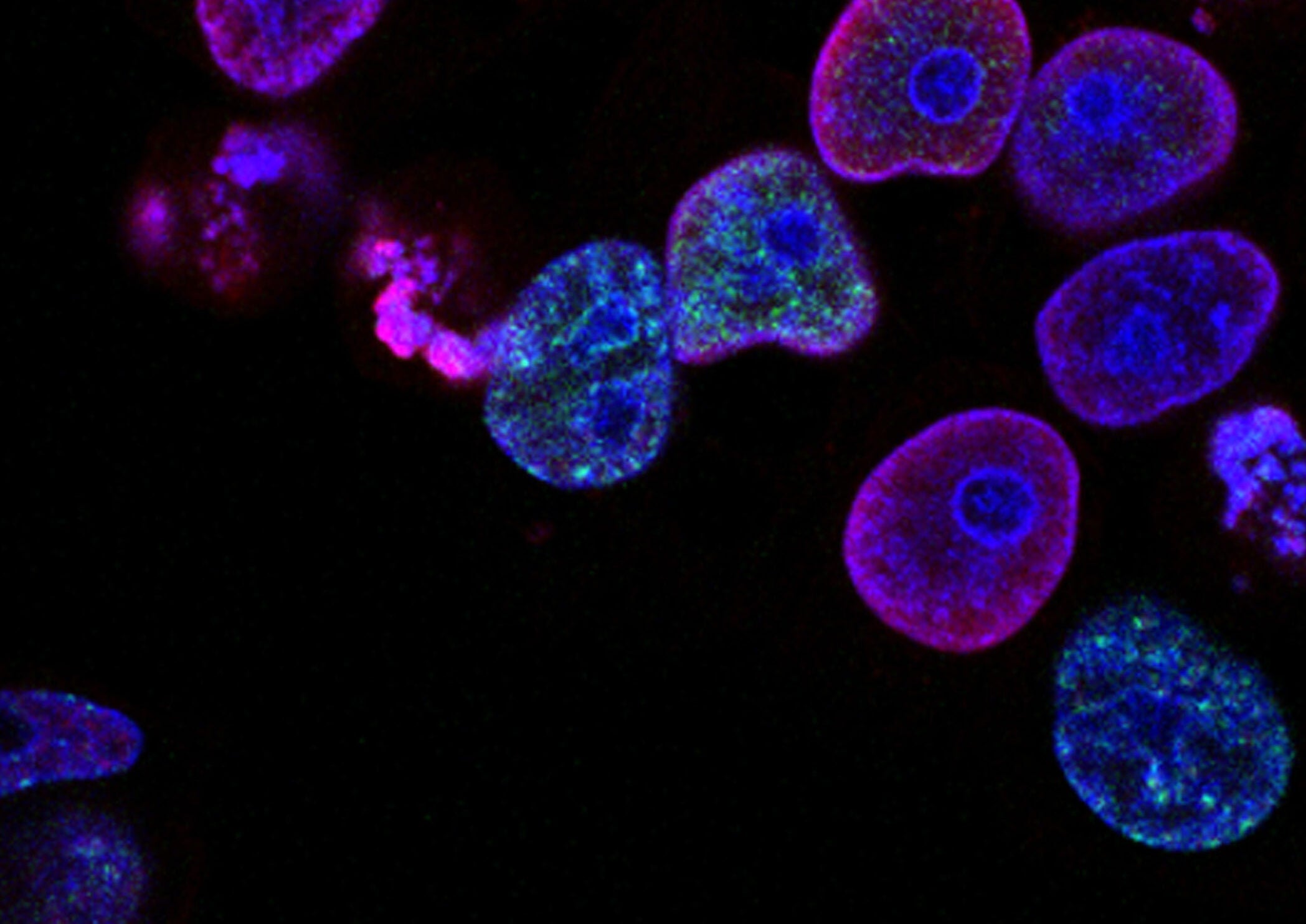 New Clarivate Report Identifies Trends in Gene Therapy Poised to Impact Patients, Payers, Regulators and Developers