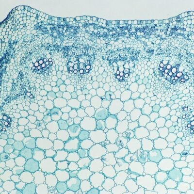 Advances in Alzheimer’s, but Knowledge Gaps Remain