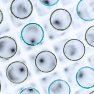 How Patient Connect addresses unmet needs at the point of care [PODCAST]