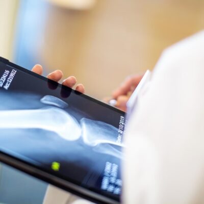 EU Large-Joint Reconstructive Implants