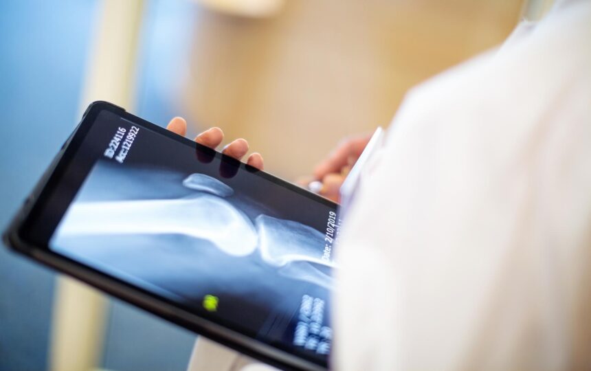 EU Large-Joint Reconstructive Implants