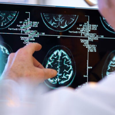U.S. Contrast Agent and Radiopharmaceutical Market Snapshot